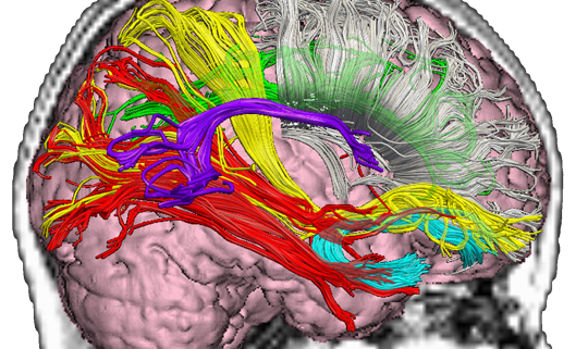 mild traumatic brain injury rehab